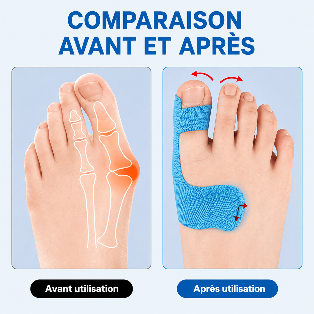 Comforté™ — Correcteur oignon pré-découpé tape kinésiologie confort actif